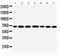 DEAD-Box Helicase 5 antibody, PA1964, Boster Biological Technology, Western Blot image 