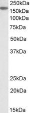 MDS1 And EVI1 Complex Locus antibody, EB09908, Everest Biotech, Western Blot image 