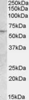 Patatin Like Phospholipase Domain Containing 2 antibody, orb19780, Biorbyt, Western Blot image 