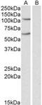 Iron regulatory protein 2 antibody, MBS421955, MyBioSource, Western Blot image 