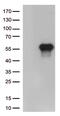 Hepatitis A Virus Cellular Receptor 2 antibody, CF812564, Origene, Western Blot image 