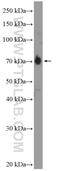 Adaptor Protein, Phosphotyrosine Interacting With PH Domain And Leucine Zipper 2 antibody, 14294-1-AP, Proteintech Group, Western Blot image 