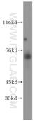 TGH antibody, 16912-1-AP, Proteintech Group, Western Blot image 