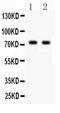 TNF Receptor Superfamily Member 1B antibody, PB9515, Boster Biological Technology, Western Blot image 