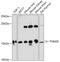 Translocase Of Outer Mitochondrial Membrane 20 antibody, 16-790, ProSci, Western Blot image 