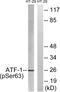 Activating Transcription Factor 1 antibody, P01600, Boster Biological Technology, Western Blot image 