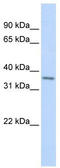 T Cell Leukemia Homeobox 1 antibody, TA330029, Origene, Western Blot image 