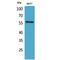 Activin A Receptor Like Type 1 antibody, LS-C386951, Lifespan Biosciences, Western Blot image 