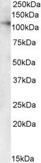 Chromobox 3 antibody, 45-029, ProSci, Western Blot image 