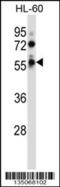 Fukutin-related protein antibody, 57-619, ProSci, Western Blot image 