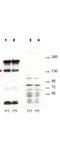 Signal-Induced Proliferation-Associated 1 antibody, A05549, Boster Biological Technology, Western Blot image 