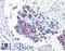 Baculoviral IAP Repeat Containing 5 antibody, LS-C142259, Lifespan Biosciences, Immunohistochemistry paraffin image 