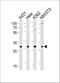 Cyclin Dependent Kinase 5 antibody, A00511-3, Boster Biological Technology, Western Blot image 