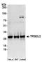 TPD52 Like 2 antibody, A304-584A, Bethyl Labs, Western Blot image 