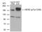 ERBB2 antibody, AP02377PU-S, Origene, Western Blot image 