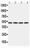 Hyaluronidase 1 antibody, PA2181-2, Boster Biological Technology, Western Blot image 
