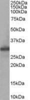 Four And A Half LIM Domains 1 antibody, NB100-1460, Novus Biologicals, Western Blot image 