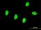 RNA Binding Motif Single Stranded Interacting Protein 2 antibody, MA5-19798, Invitrogen Antibodies, Immunofluorescence image 