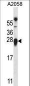 Transmembrane P24 Trafficking Protein 9 antibody, LS-C161959, Lifespan Biosciences, Western Blot image 