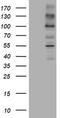 ALK Receptor Tyrosine Kinase antibody, TA801031, Origene, Western Blot image 