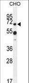 Zinc Finger Containing Ubiquitin Peptidase 1 antibody, LS-C160976, Lifespan Biosciences, Western Blot image 