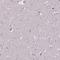 Matrix Metallopeptidase 9 antibody, HPA001238, Atlas Antibodies, Immunohistochemistry paraffin image 