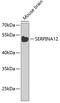 Serpin Family A Member 12 antibody, GTX66510, GeneTex, Western Blot image 