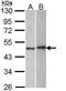 Serpin Family I Member 1 antibody, PA5-29751, Invitrogen Antibodies, Western Blot image 