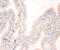 NME/NM23 Nucleoside Diphosphate Kinase 1 antibody, LS-C211210, Lifespan Biosciences, Immunohistochemistry paraffin image 