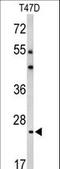 BCL2 Related Protein A1 antibody, LS-C156772, Lifespan Biosciences, Western Blot image 