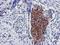 Exosome Component 7 antibody, LS-C786842, Lifespan Biosciences, Immunohistochemistry paraffin image 