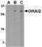 ORAI Calcium Release-Activated Calcium Modulator 2 antibody, MBS150581, MyBioSource, Western Blot image 