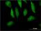 Myotrophin antibody, H00136319-M14, Novus Biologicals, Immunofluorescence image 