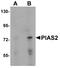 Piasx antibody, A04130, Boster Biological Technology, Western Blot image 