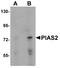 Protein Inhibitor Of Activated STAT 2 antibody, A04130, Boster Biological Technology, Western Blot image 