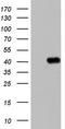 Boule Homolog, RNA Binding Protein antibody, TA804110S, Origene, Western Blot image 