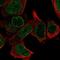 Leucine Rich Repeat Protein 1 antibody, NBP2-57485, Novus Biologicals, Immunocytochemistry image 