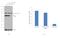 DEAD-Box Helicase 5 antibody, PA5-18260, Invitrogen Antibodies, Western Blot image 