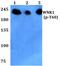 WNK1 antibody, PA5-36701, Invitrogen Antibodies, Western Blot image 