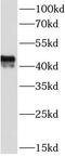 CD38 Molecule antibody, FNab01473, FineTest, Western Blot image 