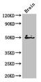 SPARC (Osteonectin), Cwcv And Kazal Like Domains Proteoglycan 1 antibody, CSB-PA730785LA01HU, Cusabio, Western Blot image 