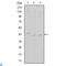 Cyclin Dependent Kinase 9 antibody, LS-C812545, Lifespan Biosciences, Enzyme Linked Immunosorbent Assay image 