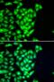 RAD51 Paralog B antibody, PA5-77079, Invitrogen Antibodies, Immunofluorescence image 