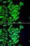 RAD51 Paralog B antibody, PA5-77079, Invitrogen Antibodies, Immunofluorescence image 