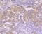 CAK antibody, NBP2-67850, Novus Biologicals, Immunohistochemistry paraffin image 