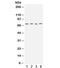 Potassium Voltage-Gated Channel Subfamily A Member 4 antibody, R32018, NSJ Bioreagents, Western Blot image 