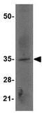 Epstein-Barr Virus Induced 3 antibody, GTX17036, GeneTex, Western Blot image 