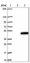 Progastricsin antibody, NBP1-91011, Novus Biologicals, Immunohistochemistry frozen image 