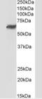 Plexin Domain Containing 1 antibody, NB100-56557, Novus Biologicals, Western Blot image 