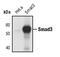 SMAD Family Member 3 antibody, PA5-17378, Invitrogen Antibodies, Western Blot image 